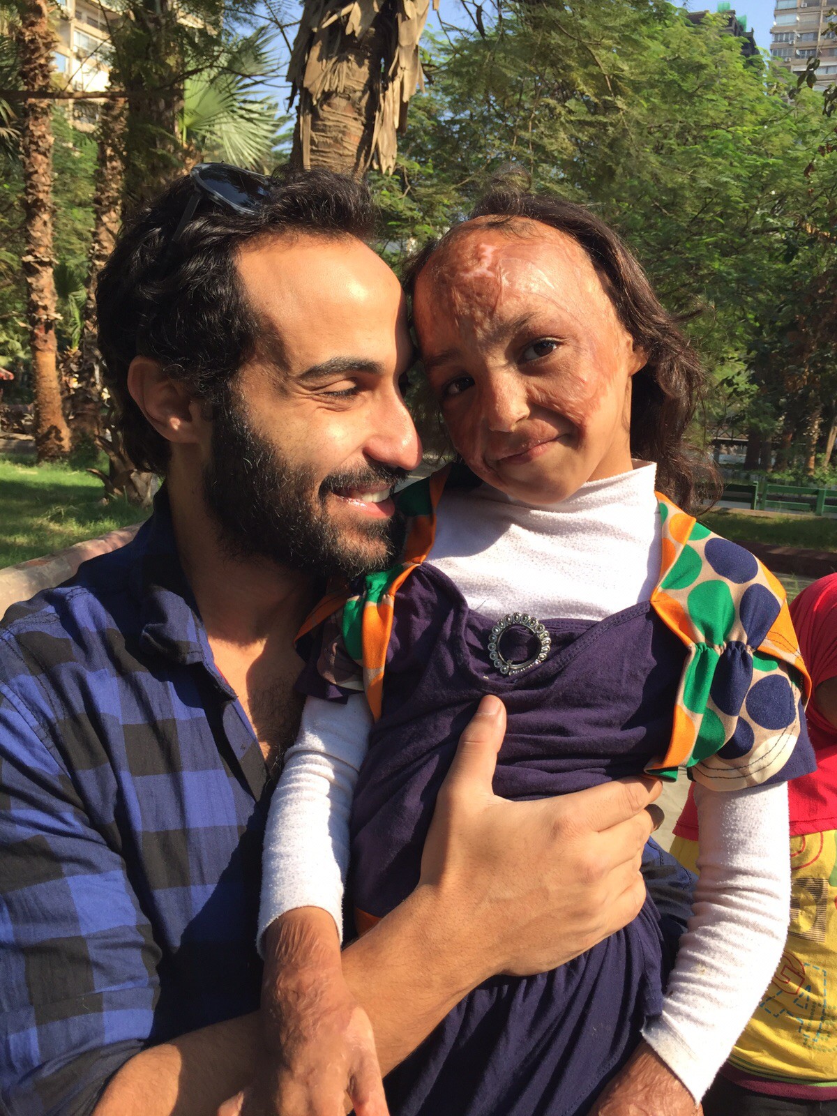 Ahmed Fahmy with burn victim