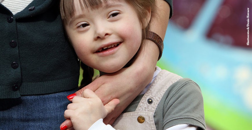 down-syndrome